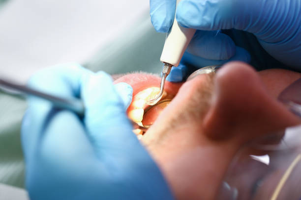 Best Emergency Treatment for Dental Infections or Abscesses in El Dorado, AR