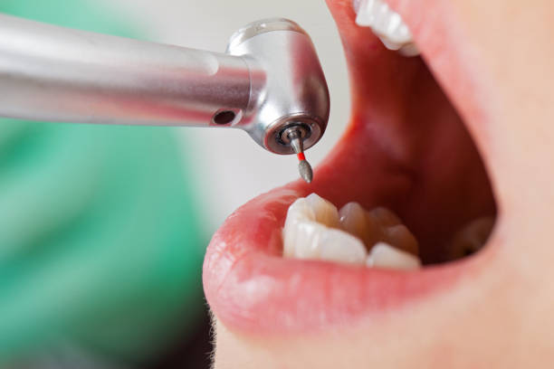 Best Emergency Treatment for Dental Infections or Abscesses in El Dorado, AR